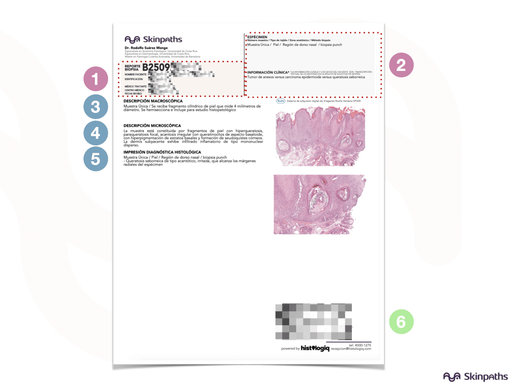 Glossary of skin biopsy terms for dermatologists | Costa Rica