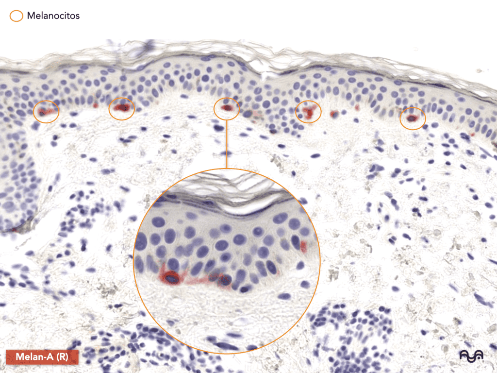 Histology of normal skin (module 2): The epidermis: layers, clue cells and microscopic reading