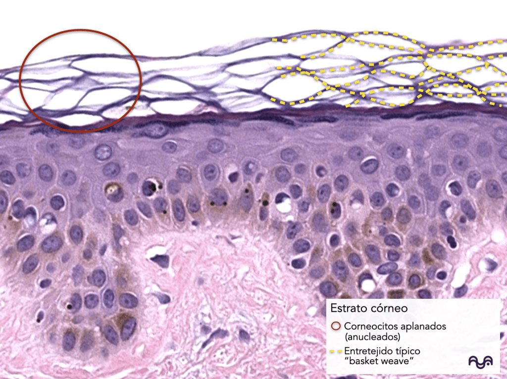 Histology of normal skin (module 2): The epidermis: layers, clue cells and microscopic reading