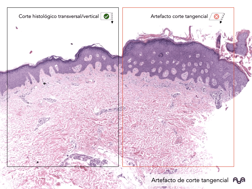 Histology of normal skin (module 2): The epidermis: layers, clue cells and microscopic reading
